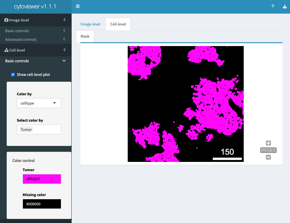 Figure 4: Cell-level visualization - Basic controls. The graphical user interface of cytoviewer for cell-level-mask with basic controls. For cell-level visualization, tumor cells (magenta) are highlighted. Note that the Mask tab is zoomable. Adapted from (Meyer, Eling, and Bodenmiller 2023)