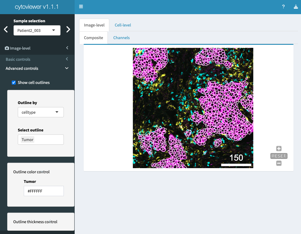 Figure 3: Image-level visualization - Advanced controls. The graphical user interface of cytoviewer for image-level-composite with advanced controls. For image-level visualization, Ecad (magenta), CD8a (cyan) and CD68 (yellow) marking tumor cells, CD8+ T cells and myeloid cells, respectively, are shown and channel color settings are as follows for all markers: Contrast: 2,5; Brightness: 1; Gamma: 1.2. Note that the Composite tab is zoomable. Scale bars: 150 µm. Adapted from (Meyer, Eling, and Bodenmiller 2023)