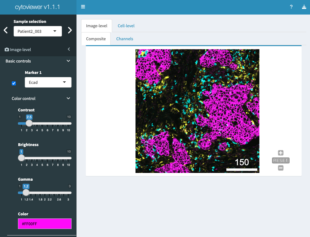 Figure 2: Image-level visualization - Basic controls. The graphical user interface of cytoviewer for image-level-composite with basic controls. For image-level visualization, Ecad (magenta), CD8a (cyan) and CD68 (yellow) marking tumor cells, CD8+ T cells and myeloid cells, respectively, are shown and channel color settings are as follows for all markers: Contrast: 2,5; Brightness: 1; Gamma: 1.2. Note that the Composite tab is zoomable. Scale bars: 150 µm. Adapted from (Meyer, Eling, and Bodenmiller 2023)